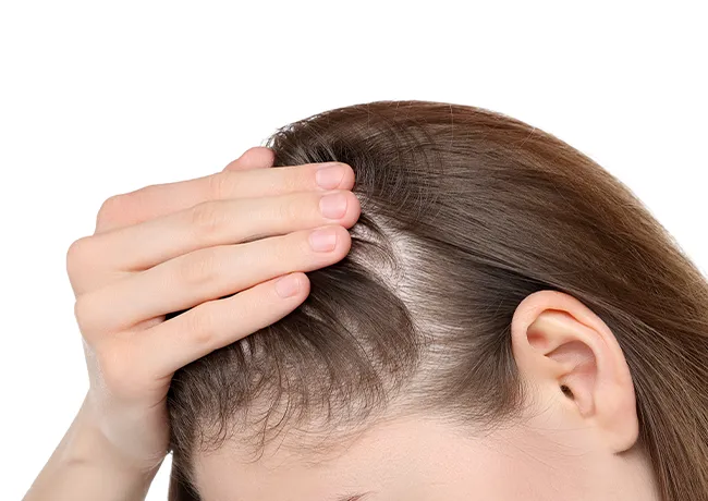 woman-thinning-hair