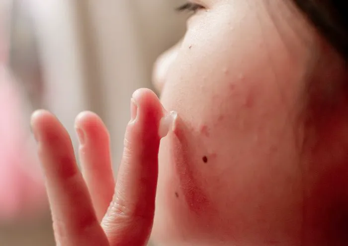 not-prepping-skin