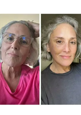 "Ricki Lake showcasing her facelift results two years post-surgery"