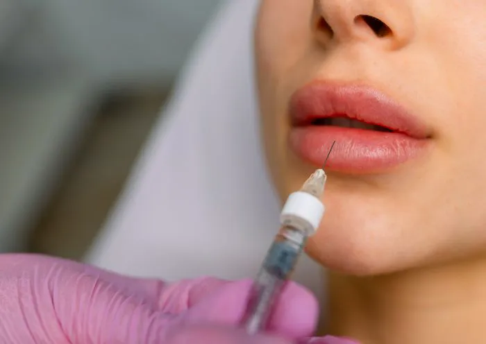 lip-filler