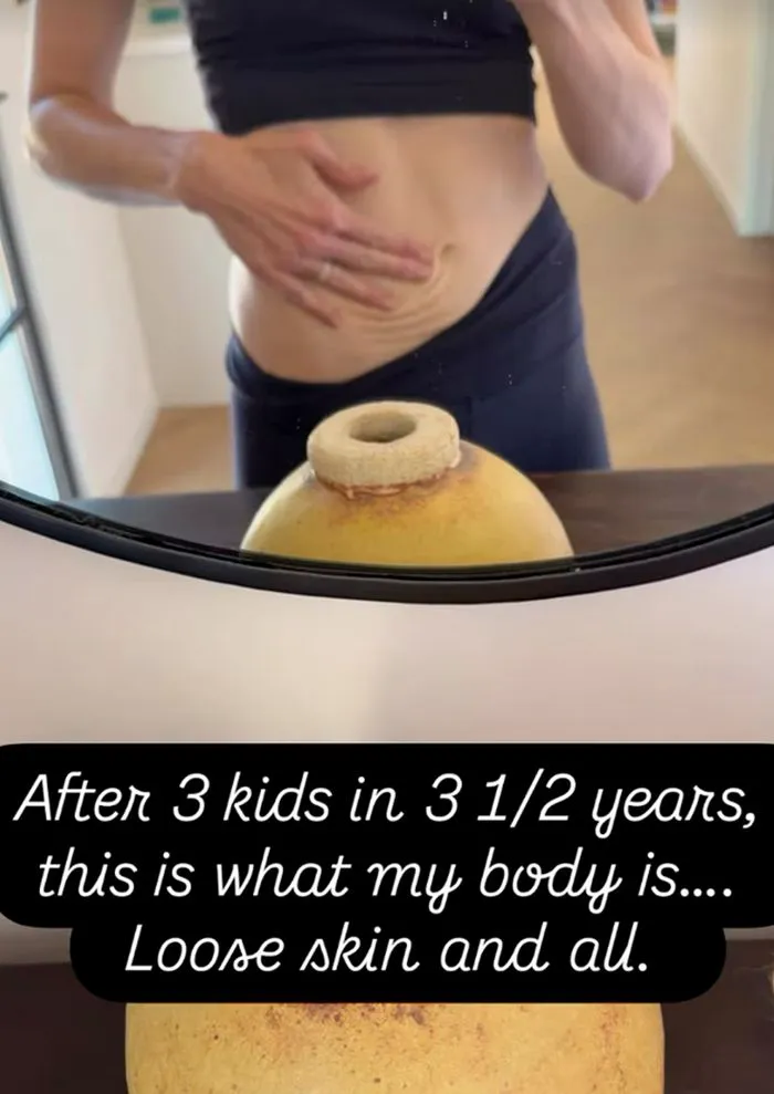 Mandy Moore shares candid moment about loose skin on Instagram.