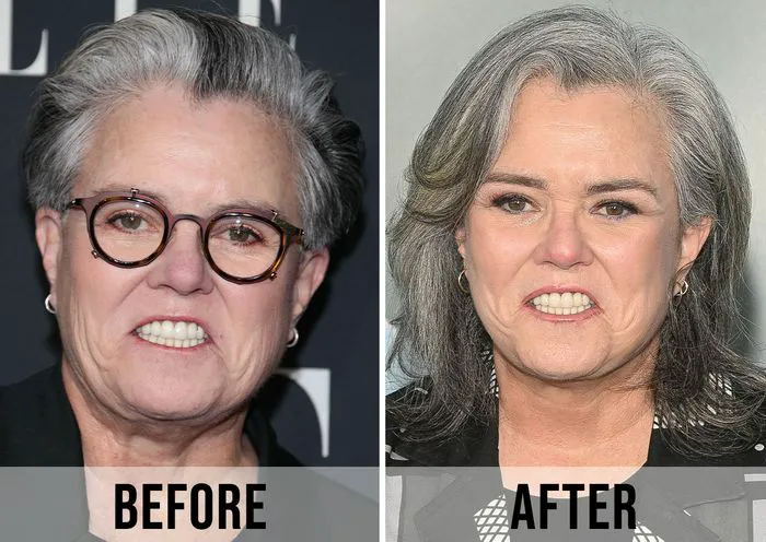 "Rosie O'Donnell before and after her weight loss transformation"