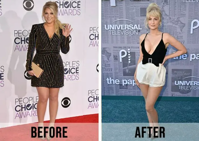 "Before and after photo of Meghan Trainor's weight loss"