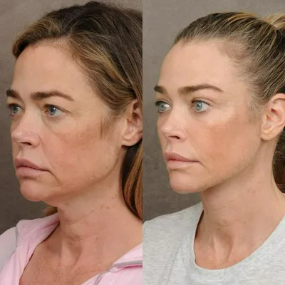 Denise Richards' stunning transformation before and after haircut.