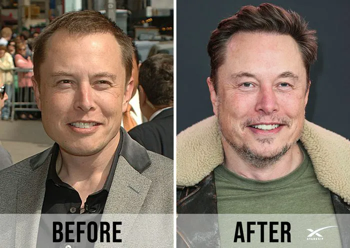 "Before and After Photos of Elon Musk's Hair"