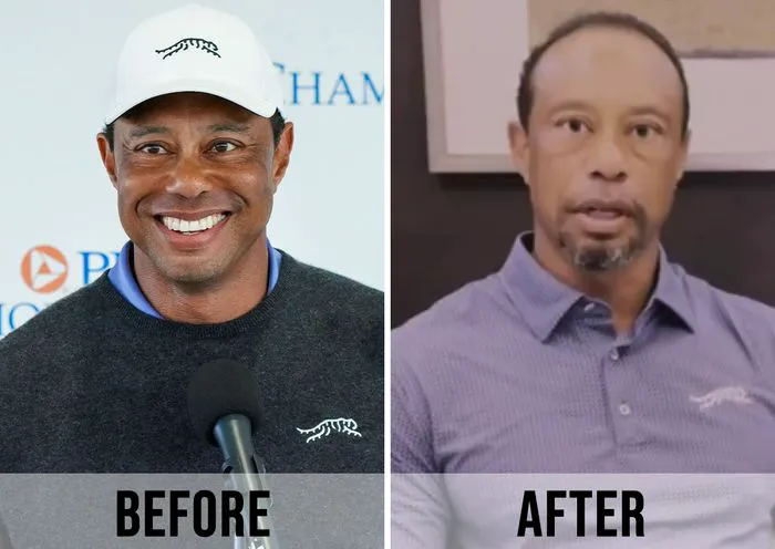 tiger woods before and after