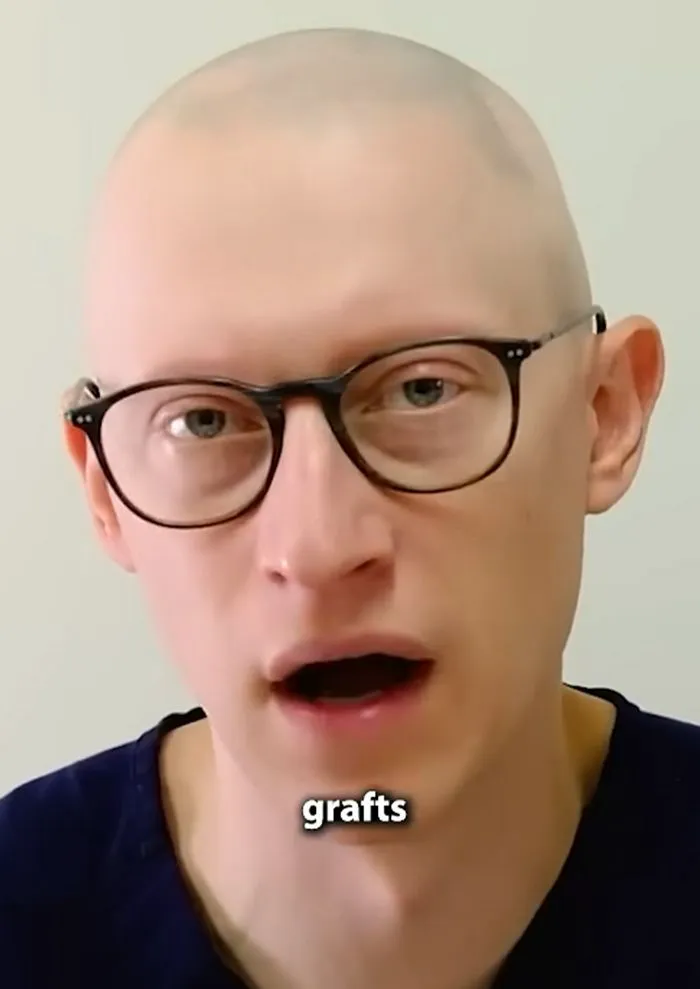 "Dr. Gary Linkov Discussing Elon Musk's Hair"