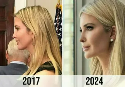 Ivanka Trump side profile 2017 vs 2024 skin appearance.