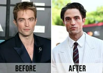 "Close-up of Robert Pattinson before and after weight loss"