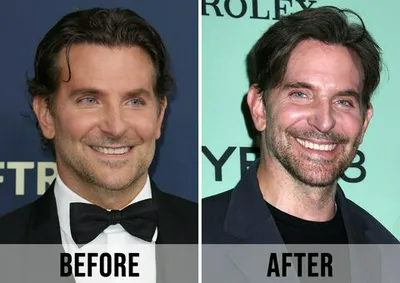 "Before and after images of Bradley Cooper"