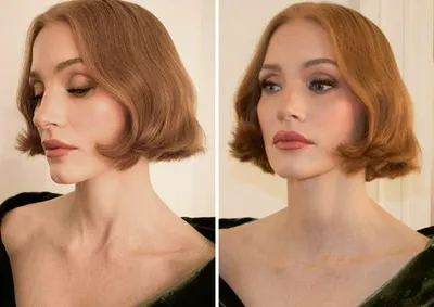 "Woman losing large amounts of hair"
