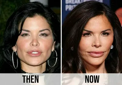 Lauren Sánchez before and after transformation