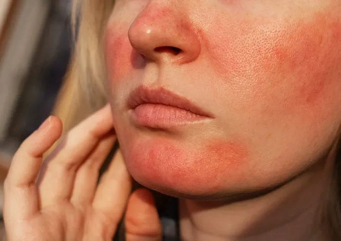 "Expert discussion about skincare"