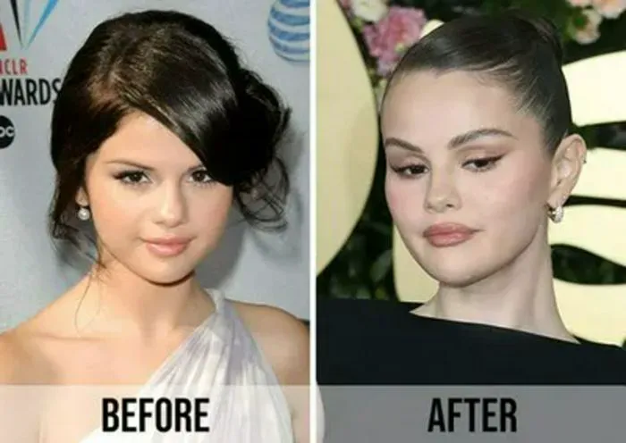 "Selena Gomez before and after transformation comparison 2008 vs 2025"