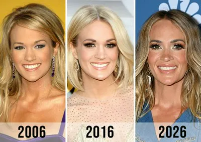 "Before and after photos of Carrie Underwood"