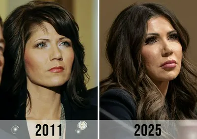 "Before-and-after photos of Kristi Noem's transformation"