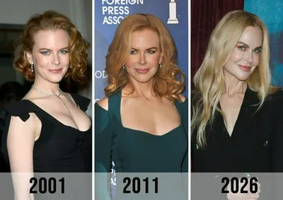Nicole Kidman before and after photos comparison