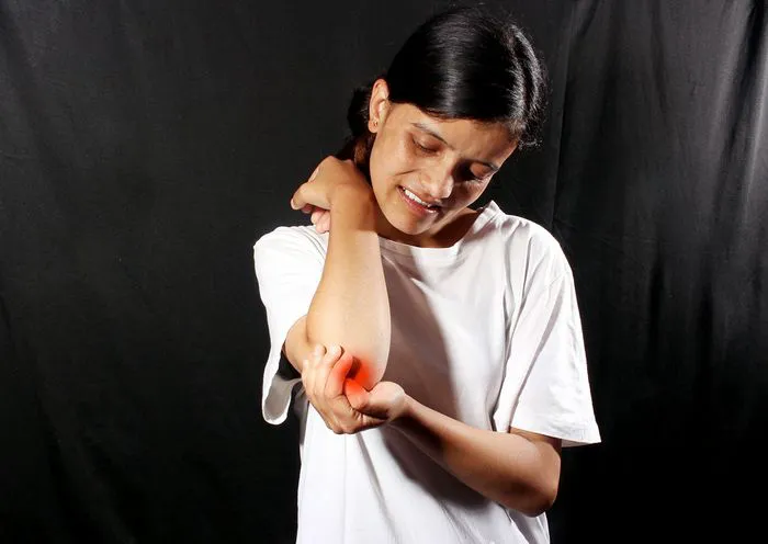 woman-holding-her-elbow